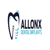 all On X Dental Implants