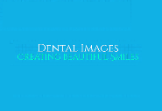 Dental Images