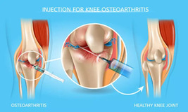 Knee Pain Treatment Specialists in Brooklyn