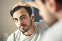 Understanding Hair Loss Treatment Options