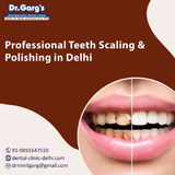 Professional Teeth Scaling and Polishing in Delhi