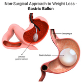 Non-Surgical Weight Loss Procedures