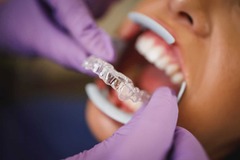 Boise Dentistry Co. - Get Premier Invisalign Teeth Aligners in Boise, ID