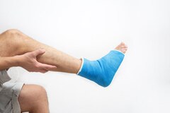 Best Knee Replacement Surgeon in Delhi