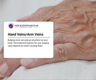 Hand Veins/Arm Veins